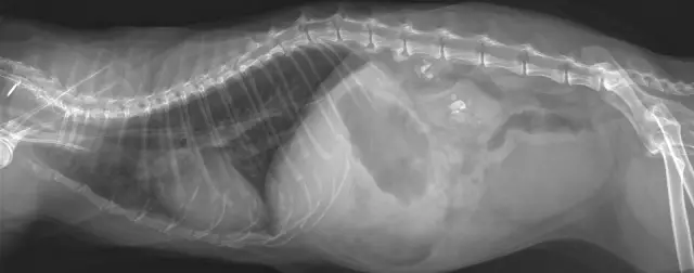 Анестезиологическая помощь при разрыве трахеи от травматического вывиха первого ребра: история болезни и обзорная литература