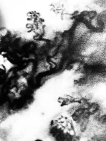 Яремный венозный рефлюкс и плазменный эндотелин-1 связаны с обмороком при кашле: пилотное исследование случай-контроль