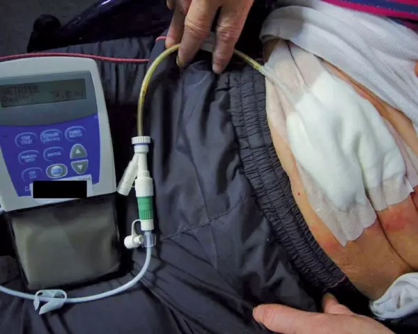 Клинический обзор: двухфазное положительное давление в дыхательных путях и сброс давления в дыхательных путях