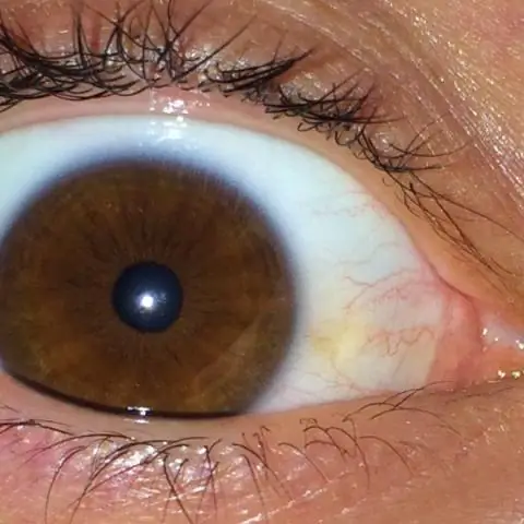 Алкоголь Вопросы и ответы