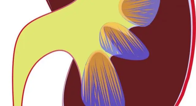 Об Инициативе ХЗП - Инициатива по хроническим заболеваниям почек