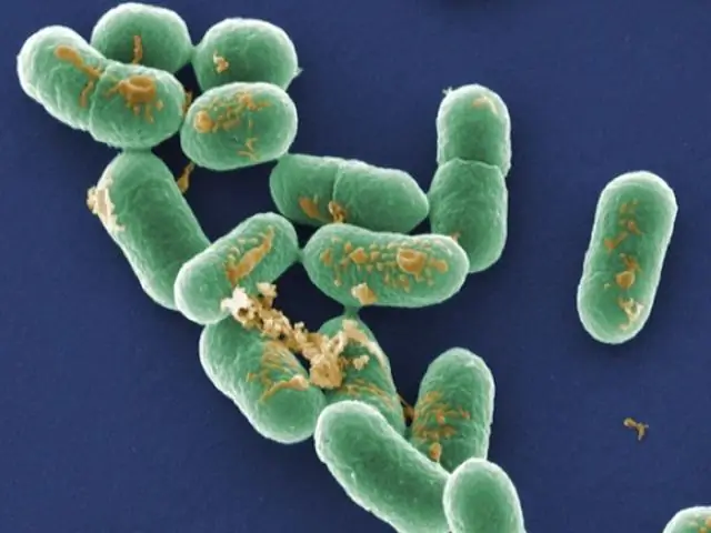 Многоуровневая вспышка листериоза, связанная с коммерчески производимыми предварительно упакованными карамельными яблоками из яблок Bidart Bros. листериоз