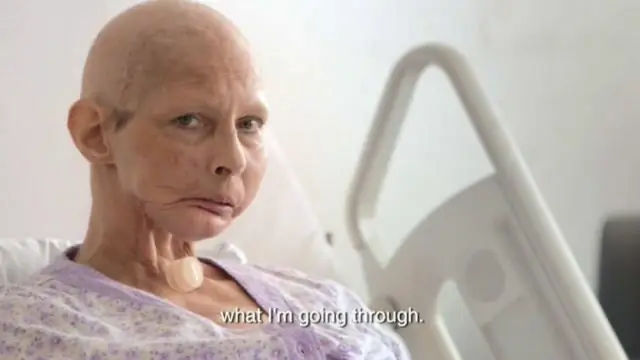 Что нужно знать о вакцинации против кори Стенограмма - CDC-TV