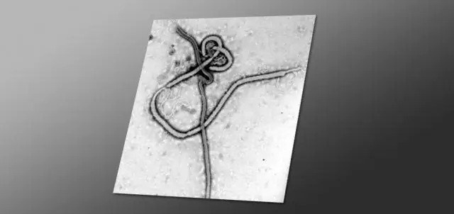 Определения случая артрита