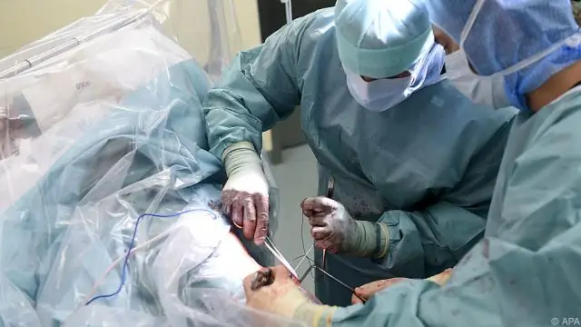 Частота почечной недостаточности выше у афроамериканцев: исследование