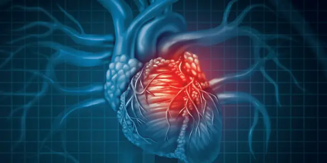 Что такое болезнь сердца? Симптомы, причины, диагностика, лечение и профилактика