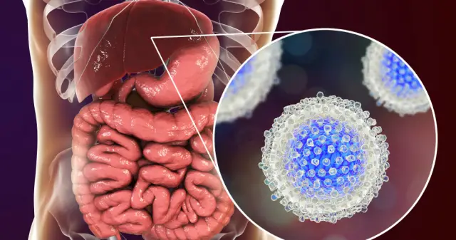 Как лечится гепатит С?