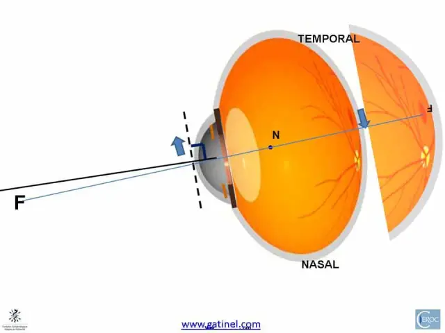 Аметропия: Коррекция глаз при проверке возраста