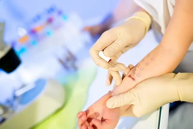 Аллергия, вызванная генетическим дефектом?